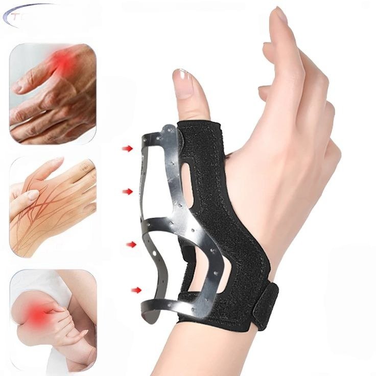 Splint Application